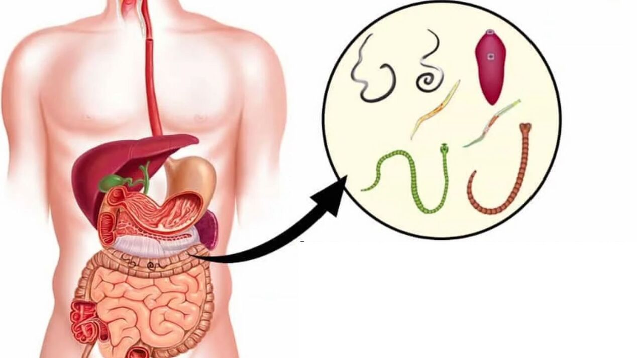 tipuri de paraziți din organism