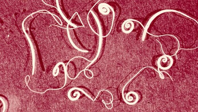 Trichinella
