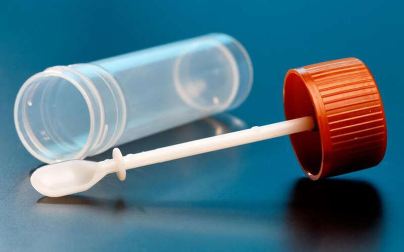 Test de scaun pentru viermi