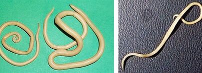 ce paraziți poate avea o persoană